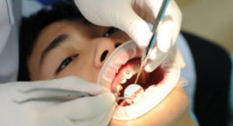 Bao nhiêu tuổi thì niềng răng được & phương pháp cho từng độ tuổi