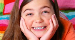Giá niềng răng cho trẻ em – Cập nhật bảng giá mới nhất 2017
