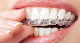 Sự thật gây SHOCK về phương pháp niềng răng không mắc cài eCligner