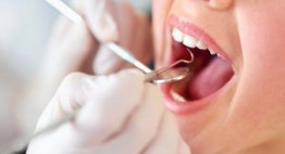 Cạo vôi răng thường xuyên có tốt không?