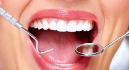 Lấy cao răng có an toàn không? Những điều cần biết