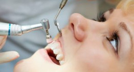 Lấy cao răng mất bao nhiêu thời gian thì phù hợp?