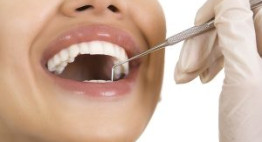 Nên duy trì lấy cao răng mấy tháng một lần là tốt nhất?