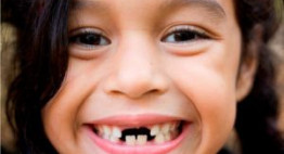 Hướng dẫn nhổ răng cho bé đúng cách và an toàn nhất