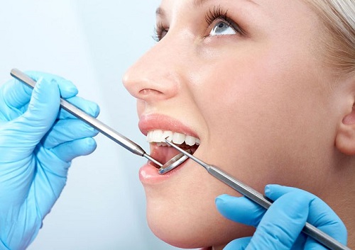 dùng hàm duy trì sau niềng răng 3