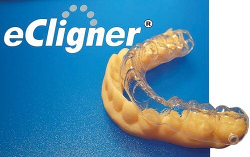 niềng răng không mắc cài eCligner 1