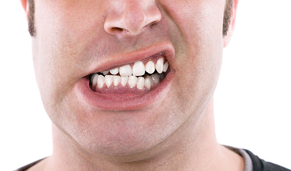 cách chữa bệnh nghiến răng
